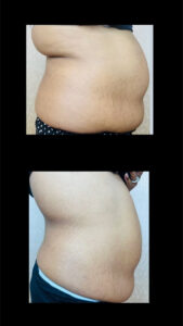 Weight Loss Medications-Toronto