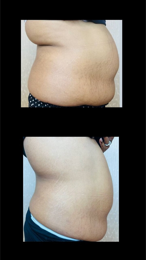 Weight Loss Medications-Toronto