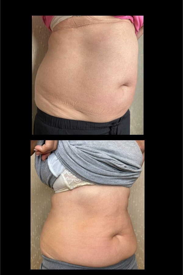 Weight Loss Medications-Toronto