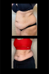 Weight Loss Medications-Toronto-03