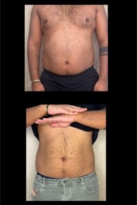 Weight Loss Medications-Toronto