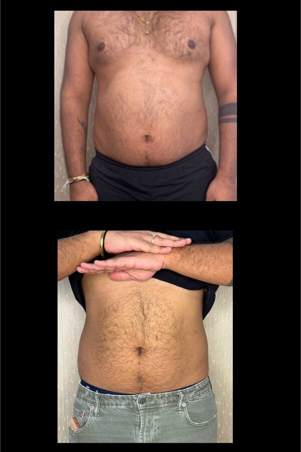 Weight Loss Medications-Toronto