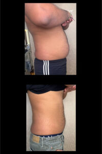 Weight Loss Medications-Toronto