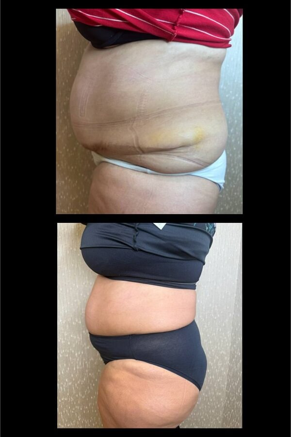 Weight Loss Medications-Toronto