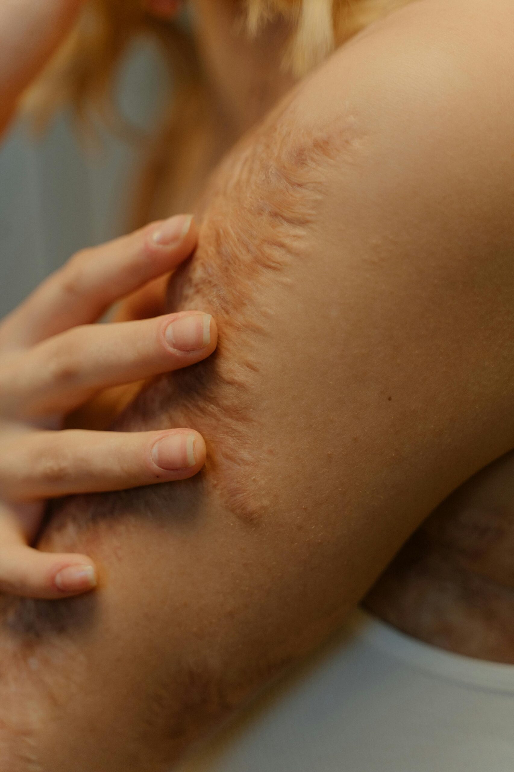 Detailed view of an arm showing natural scars and skin texture, emphasizing body positivity.