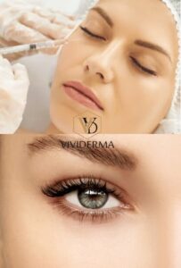 Non Surgical Blepharoplasty 