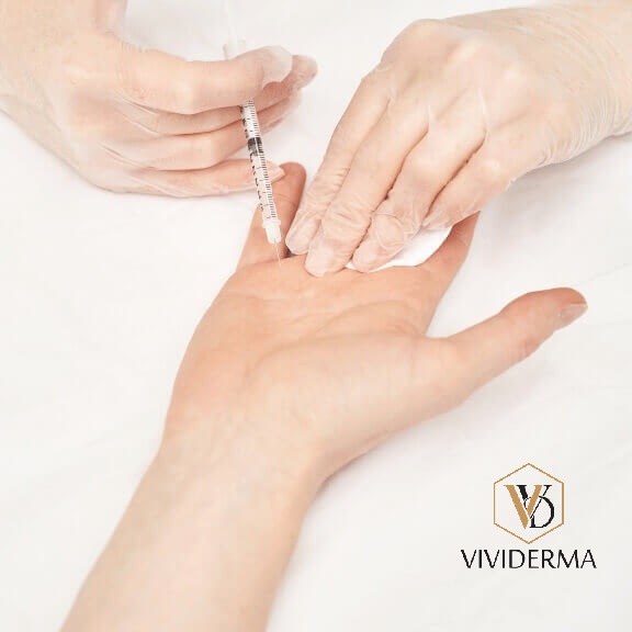 Non surgical Medical hyperhidrosis treatment