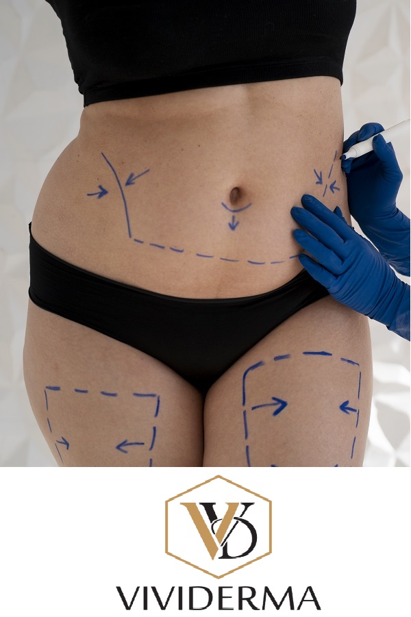 What Are Lipolysis Injections, Their Benefits and Risks