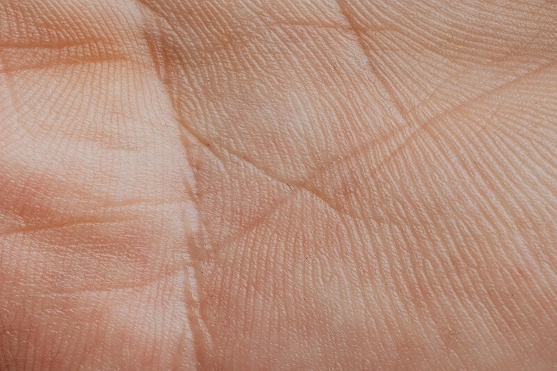 How Long Do Hand Fillers Last Duration & Results