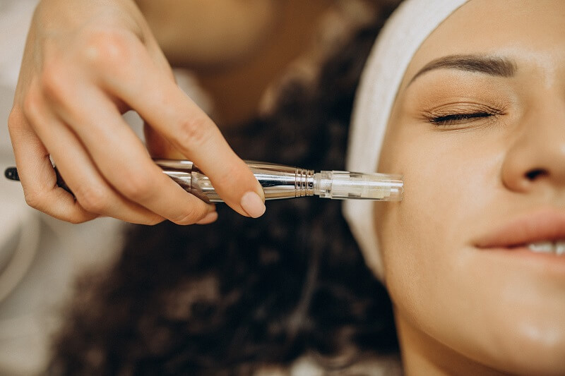 How Many Microneedling Sessions Do You Need